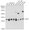 Nicotinamide N-Methyltransferase antibody, GTX32754, GeneTex, Western Blot image 