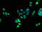 Phosphatidylcholine Transfer Protein antibody, A63118-100, Epigentek, Immunofluorescence image 