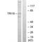 Midline 1 antibody, A01774, Boster Biological Technology, Western Blot image 