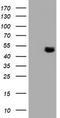 Tubulin Alpha Like 3 antibody, CF503908, Origene, Western Blot image 