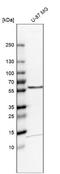 Target Of Myb1 Membrane Trafficking Protein antibody, NBP2-55152, Novus Biologicals, Western Blot image 