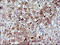 Serpin Family B Member 3 antibody, LS-C338258, Lifespan Biosciences, Immunohistochemistry paraffin image 