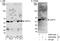 Ubiquitin Specific Peptidase 14 antibody, A300-920A, Bethyl Labs, Western Blot image 