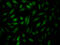 HIF-2-alpha antibody, CSB-RA904931A0HU, Cusabio, Immunofluorescence image 