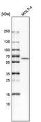 Adenosine Deaminase 2 antibody, NBP1-89238, Novus Biologicals, Western Blot image 