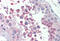Lysine Methyltransferase 2B antibody, MBS242382, MyBioSource, Immunohistochemistry frozen image 