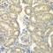 Acyl-CoA Synthetase Long Chain Family Member 5 antibody, GTX30019, GeneTex, Immunohistochemistry paraffin image 