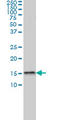 Mediator Complex Subunit 31 antibody, LS-C133746, Lifespan Biosciences, Western Blot image 