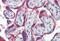 Platelet Derived Growth Factor Subunit B antibody, MBS247170, MyBioSource, Immunohistochemistry paraffin image 