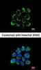 Ectonucleotide Pyrophosphatase/Phosphodiesterase 2 antibody, orb13267, Biorbyt, Immunofluorescence image 