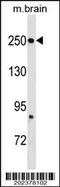 FAS antibody, TA324352, Origene, Western Blot image 