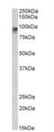 Neuroligin-2 antibody, NBP1-00220, Novus Biologicals, Western Blot image 