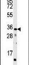 CTD Small Phosphatase 2 antibody, PA5-15573, Invitrogen Antibodies, Western Blot image 