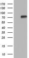 Protein Phosphatase 2 Regulatory Subunit B'Delta antibody, TA804123, Origene, Western Blot image 