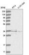 Ring Finger Protein 220 antibody, HPA027577, Atlas Antibodies, Western Blot image 