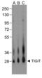 T Cell Immunoreceptor With Ig And ITIM Domains antibody, RF16056, ProSci, Western Blot image 