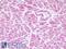 NADH:Ubiquinone Oxidoreductase Core Subunit V1 antibody, LS-B9338, Lifespan Biosciences, Immunohistochemistry paraffin image 