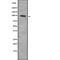 Lipin 1 antibody, abx216599, Abbexa, Western Blot image 