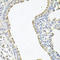 Sodium Channel Epithelial 1 Gamma Subunit antibody, STJ27879, St John