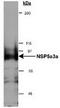 Sperm Antigen With Calponin Homology And Coiled-Coil Domains 1 antibody, TA301748, Origene, Western Blot image 