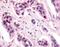 Cyclin Dependent Kinase 12 antibody, GTX70983, GeneTex, Immunohistochemistry paraffin image 