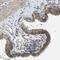 Catenin Delta 1 antibody, NBP1-85383, Novus Biologicals, Immunohistochemistry frozen image 