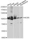 Minichromosome Maintenance Complex Component 5 antibody, A5556, ABclonal Technology, Western Blot image 
