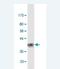 Laminin Subunit Alpha 2 antibody, H00003908-M02, Novus Biologicals, Western Blot image 