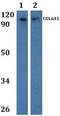 Collagen Type VI Alpha 1 Chain antibody, A02226-1, Boster Biological Technology, Western Blot image 