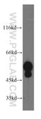 Keratin 13 antibody, 10164-2-AP, Proteintech Group, Western Blot image 