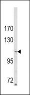 Sorbin And SH3 Domain Containing 2 antibody, TA324888, Origene, Western Blot image 