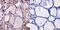 Thyroid Hormone Receptor Beta antibody, GTX22744, GeneTex, Immunohistochemistry paraffin image 
