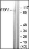Eukaryotic Translation Elongation Factor 2 antibody, orb95923, Biorbyt, Western Blot image 