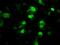 Protein Phosphatase Methylesterase 1 antibody, MA5-25027, Invitrogen Antibodies, Immunocytochemistry image 