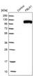 Fibulin 1 antibody, PA5-51612, Invitrogen Antibodies, Western Blot image 