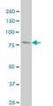 Phosphofructokinase, Liver Type antibody, H00005211-M03, Novus Biologicals, Western Blot image 