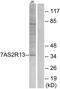 Taste 2 Receptor Member 13 antibody, GTX87215, GeneTex, Western Blot image 
