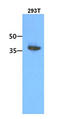 Acyl-CoA Thioesterase 7 antibody, LS-C200828, Lifespan Biosciences, Western Blot image 