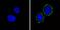 Insulin Receptor antibody, MA5-13764, Invitrogen Antibodies, Immunofluorescence image 