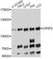 Cleavage And Polyadenylation Specific Factor 2 antibody, A9297, ABclonal Technology, Western Blot image 
