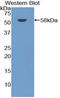 Atypical Chemokine Receptor 1 (Duffy Blood Group) antibody, LS-C293715, Lifespan Biosciences, Western Blot image 