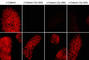 Catenin Delta 1 antibody, CM3571, ECM Biosciences, Immunocytochemistry image 