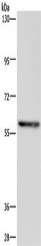 TGF-Beta Activated Kinase 1 (MAP3K7) Binding Protein 1 antibody, TA350152, Origene, Western Blot image 