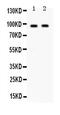 Protein CIP2A antibody, PA5-79553, Invitrogen Antibodies, Western Blot image 