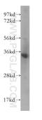 Corticotropin Releasing Hormone antibody, 10944-1-AP, Proteintech Group, Western Blot image 