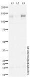 Endothelin Converting Enzyme 1 antibody, ab71829, Abcam, Western Blot image 