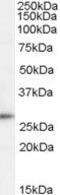 Tumor protein D52 antibody, PA5-18796, Invitrogen Antibodies, Western Blot image 