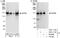 Scaffold Attachment Factor B2 antibody, A301-112A, Bethyl Labs, Western Blot image 