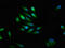 Sodium Voltage-Gated Channel Alpha Subunit 9 antibody, LS-C675028, Lifespan Biosciences, Immunofluorescence image 