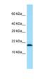 Transmembrane Protein 50B antibody, orb326327, Biorbyt, Western Blot image 